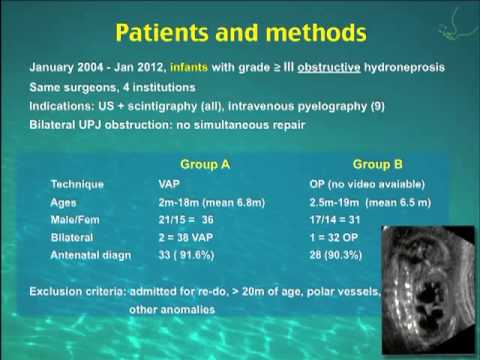 VIDEO-ASSISTED EXTRACORPOREAL VERSUS OPEN PYELOPLASTY IN INFANTS: A ...